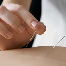 Heilpraktikerin Stuttgart Akupunktur